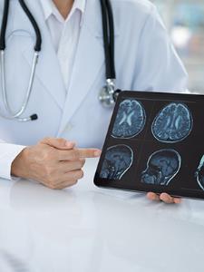 Expert caregiver showing brain scans on tablet device